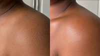 Diabetic Dry Skin vs. Regular Dry Skin: Why Daily Moisture Support Matters